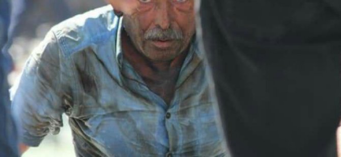 YOKSULLUĞUN UTANÇ FOTOĞRAFI