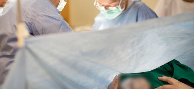 YÜZÜ OLMAYAN BEBEK DÜNYAYA GELDİ DOKTORU AÇIĞA ALINDI