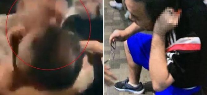 HONG KONG'DA MECLİS ÜYESİNİN KULAĞINI KOPARDILAR
