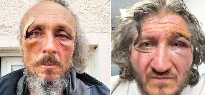 KÜRESEL SUMUD FİLOSU İSTANBUL'DA 31 AKTİVİST YARALI