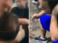 HONG KONG'DA MECLİS ÜYESİNİN KULAĞINI KOPARDILAR