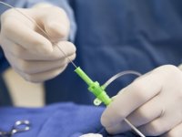 BYPASS AMELİYATI GEÇİREN HASTALAR HAKKINDA ŞAŞIRTAN ARAŞTIRMA