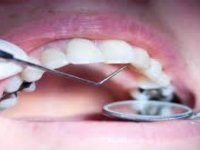 DİŞ POLİKLİNİKLERİ VATANDAŞLARIN CEBİNİ BOŞALTIYOR