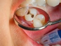 Diş Hastaneleri Bulaşıcı Hastalıklara Davetiye Çıkartıyor